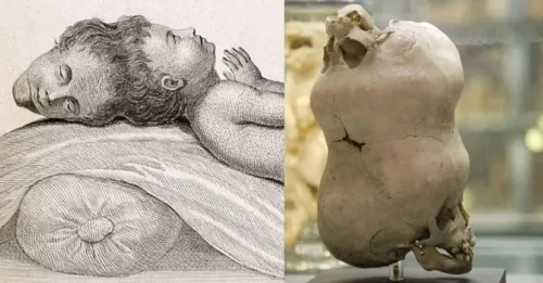 Born with Two Heads & A 'Second Brain' Voice: Was This Child a Medical Miracle... or Something More Sinister?