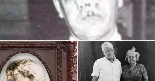The Tragic Life of the Man with Three Eyes, Two Noses, and a Split Face: An Unwilling Star