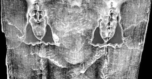 Mystery of the Shroud: Is This 2,000-Year-Old Cloth Hiding Jesus's True Face?
