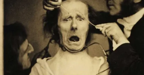 19th Century Human Experiments Produced Horrifying Photos