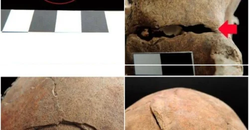 Medieval Burial Unearthed In Croatia That Contains The Decapitated And Contorted Remains Of A ‘Vampire’