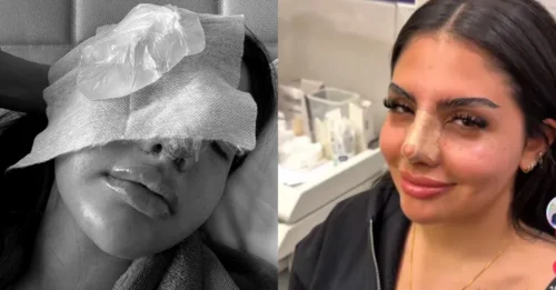 Huda Mustafa Confesses Failed Cosmetic Procedure: The Real Reason Behind Her Unrecognizable Look Pre-Love Island!