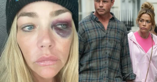 Bombshell: Denise Richards Claims Ex-Husband Aaron Phypers Threatened Her Life Throughout Their Marriage