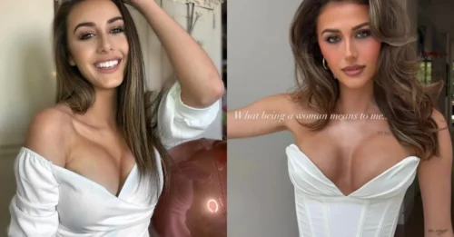 She Calls Them 'Perfect' – Fans Stunned as Star Claps Back at Botched Surgery Rumors!