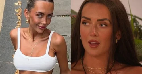 Jess White Shockingly Unrecognizable – Fans Demand Answers Over Drastic Face Change!