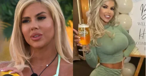 Former Love Island Star Officially Debuts a Completely New Look After Cosmetic Surgery