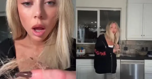 HORRIFIC BURNING ACCIDENT: Love Island Star Liv Walker's Hair Goes Up in Flames in an Instant... All Because of Dinner!