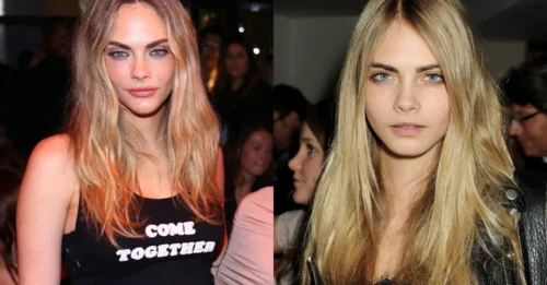FACE THE TRUTH: What REALLY Happened to Cara Delevingne's Expressive Face? She Now Looks Just Like a 'Love Island' Contestant!