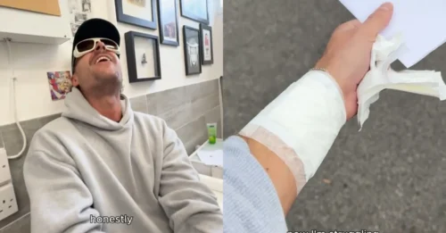 MEMORY ERASED! Love Island's Harry OFFICIALLY REMOVES Emma Tribute Tattoo, Turning TikTok War Into a Spectacular 'Annihilation'