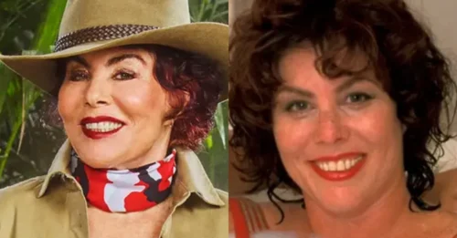 NOTHING'S LEFT HIDDEN! After years of silence, Ruby Wax comes clean on every cosmetic procedure she's ever had. The truth will surprise you!